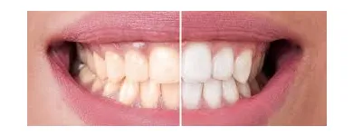 Business 4 image EVE DENTAL CENTRE - DENTIST PAKENHAM Dentist in Cranbourne North VIC