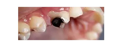 Business 5 image EVE DENTAL CENTRE - DENTIST PAKENHAM Dentist in Cranbourne North VIC