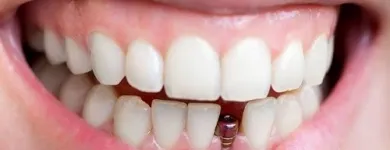 Business 2 image EVE DENTAL CENTRE Dentist in Cranbourne North VIC