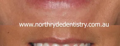 Business 1 image NORTH RYDE DENTISTRY North Ryde Dentist in Macquarie Park NSW