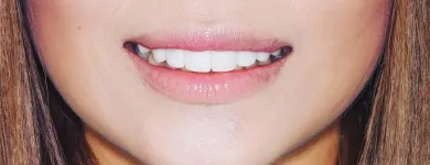 Business 4 image NORTH RYDE DENTISTRY North Ryde Dentist in Macquarie Park NSW