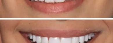 Business 1 image NORTH SYDNEY DENTISTRY Family Dental Care in North Sydney NSW
