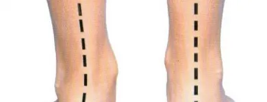 Business 1 image PODIATRY CARE MODBURY Sports Medicine in Modbury SA