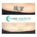 THINK AGAIN LASER CLINIC - BRISBANE Tattoo Removal in Fortitude Valley QLD